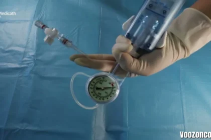 Inflatom: Smart Automated Inflation Devices Explained